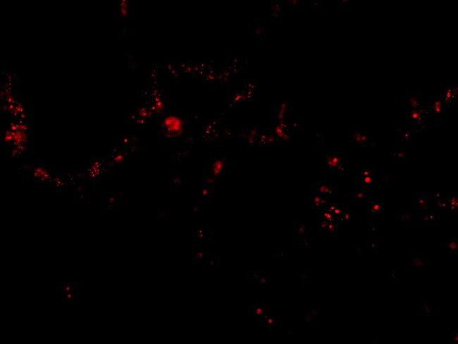 p53R2 Antibody in Immunohistochemistry (IHC)