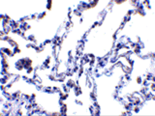 p53R2 Antibody in Immunohistochemistry (IHC)