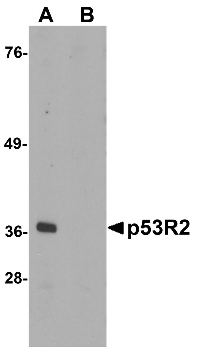 p53R2 Antibody in Western Blot (WB)