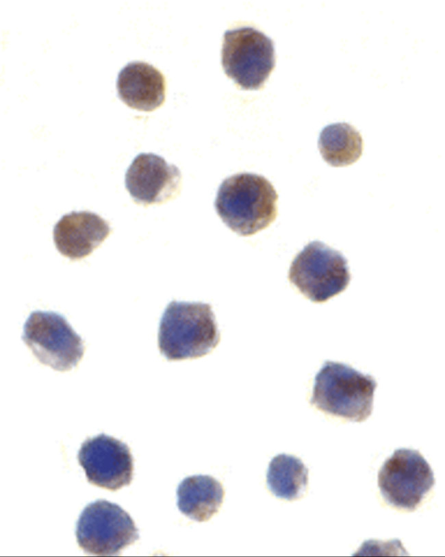 CHK2 Antibody in Immunocytochemistry (ICC/IF)