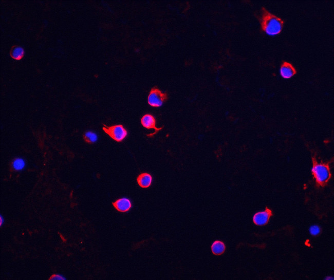 CHK2 Antibody in Immunocytochemistry (ICC/IF)