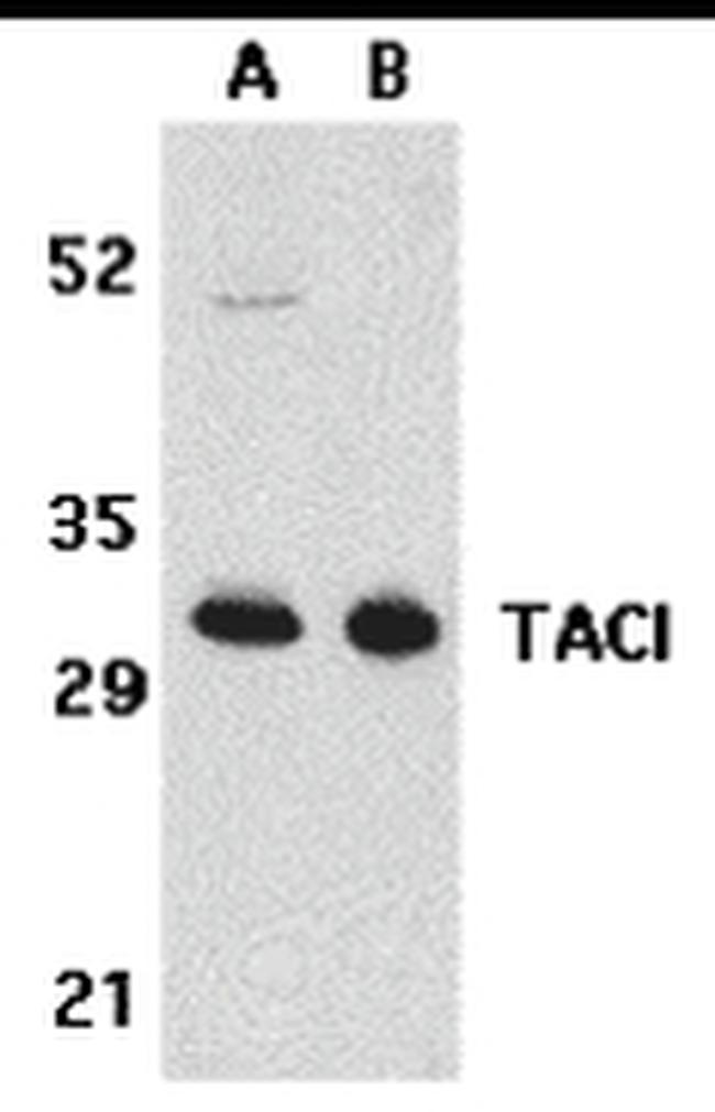 CD267 (TACI) Antibody in Western Blot (WB)