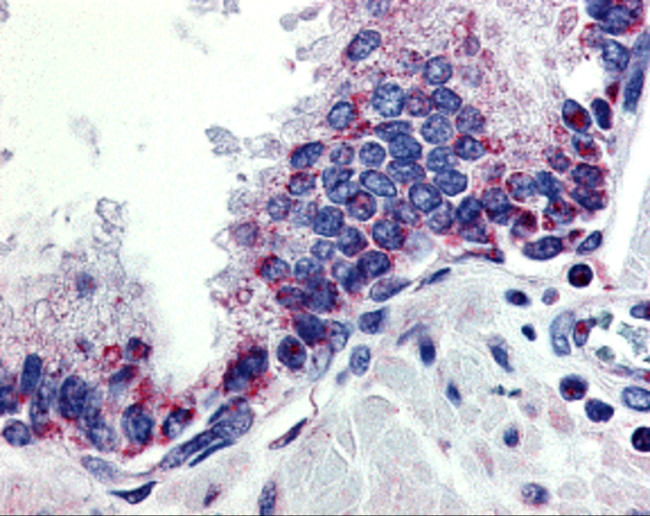 APRIL Antibody in Immunohistochemistry (IHC)