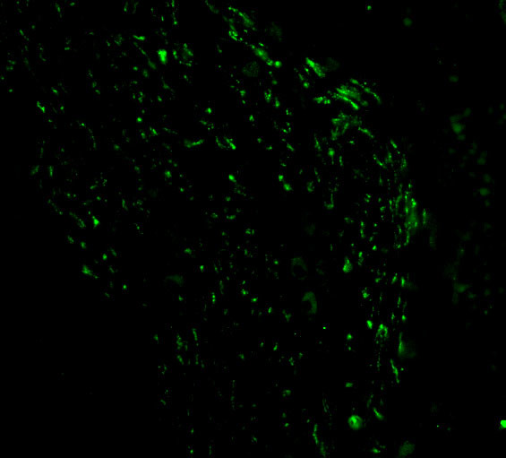 NOXA Antibody in Immunocytochemistry (ICC/IF)