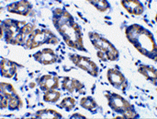 NOXA Antibody in Immunohistochemistry (IHC)