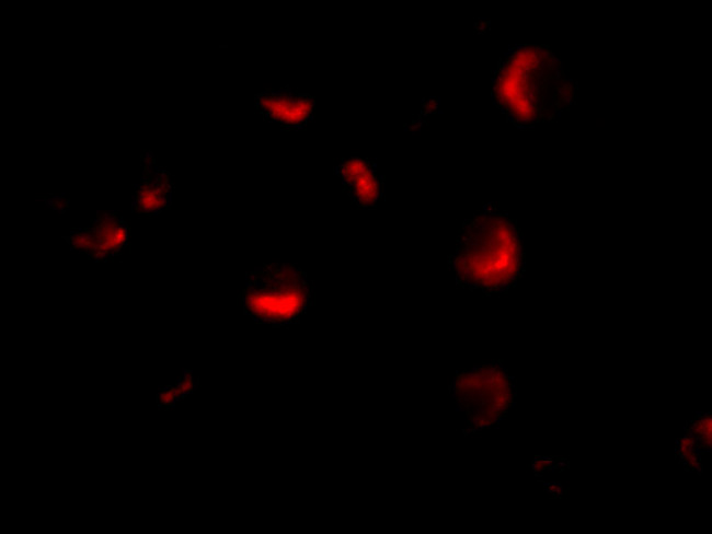 MTA2 Antibody in Immunocytochemistry (ICC/IF)