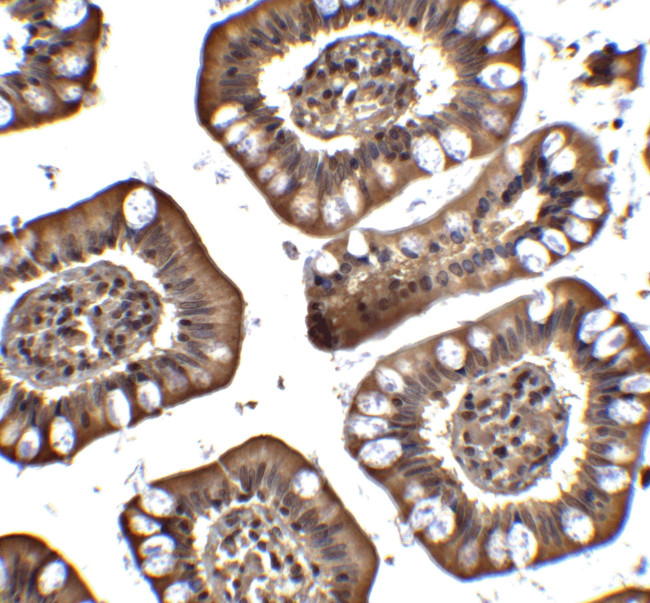 MTA2 Antibody in Immunohistochemistry (IHC)