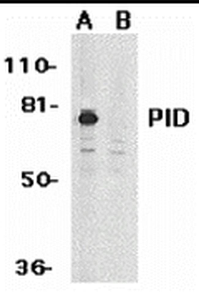 MTA2 Antibody in Western Blot (WB)