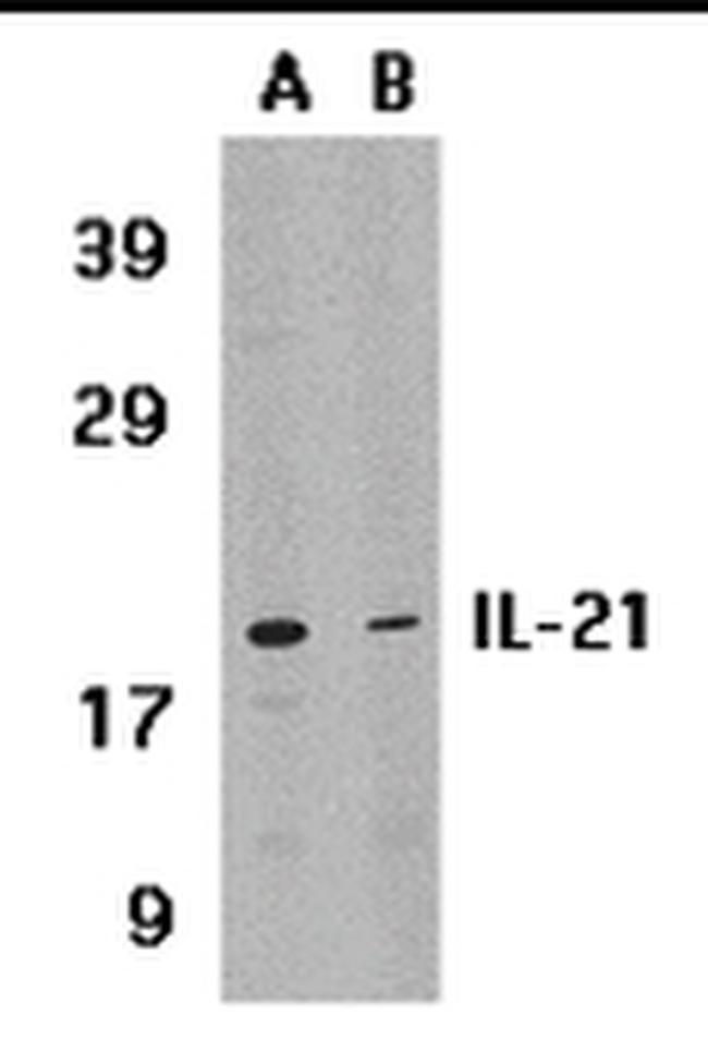 IL-21 Antibody in Western Blot (WB)