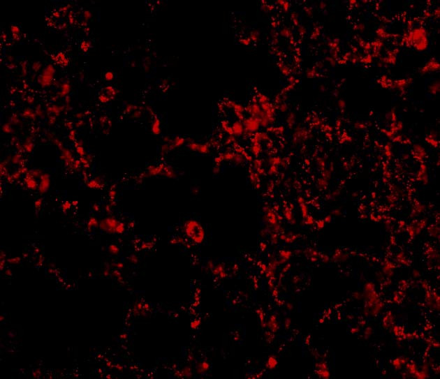 IL21R Antibody in Immunocytochemistry (ICC/IF)