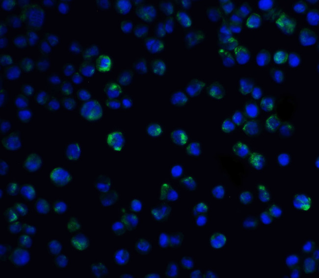 IL21R Antibody in Immunocytochemistry (ICC/IF)