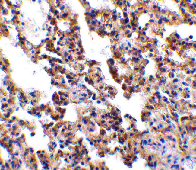 IL21R Antibody in Immunohistochemistry (IHC)