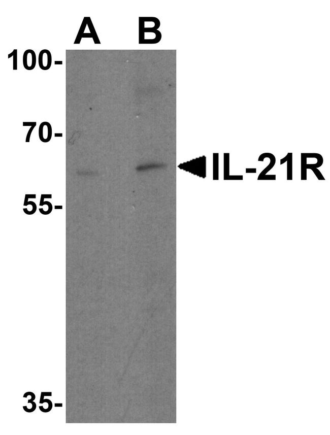 IL21R Antibody in Western Blot (WB)