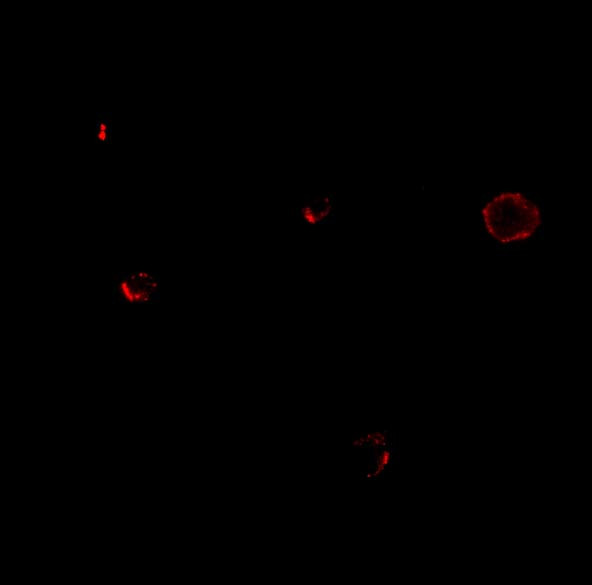 TCCR Antibody in Immunocytochemistry (ICC/IF)