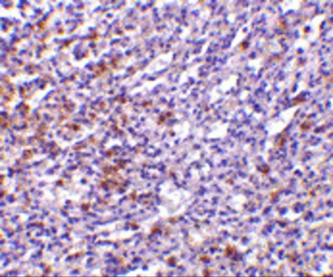 TCCR Antibody in Immunohistochemistry (IHC)