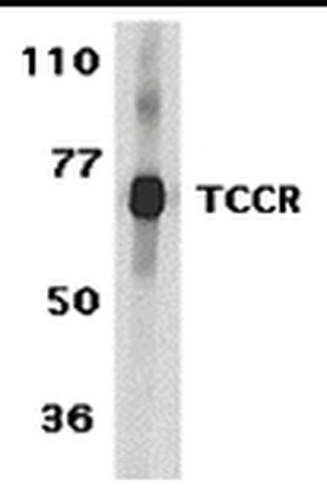 TCCR Antibody in Western Blot (WB)