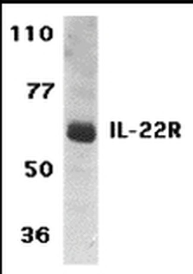 IL-22 Receptor alpha Antibody in Western Blot (WB)