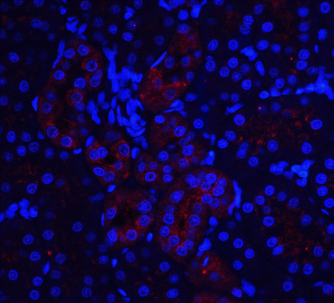 IL-22 Receptor alpha Antibody in Immunohistochemistry (IHC)