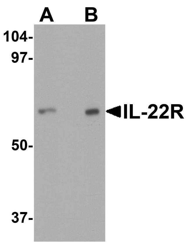 IL-22 Receptor alpha Antibody in Western Blot (WB)