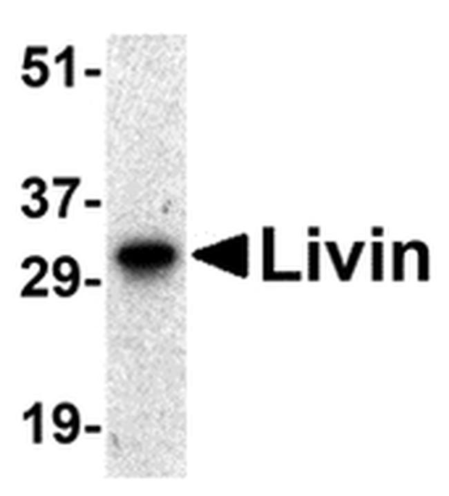 Livin Antibody in Western Blot (WB)