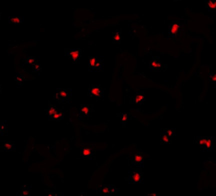 NOD2 Antibody in Immunocytochemistry (ICC/IF)