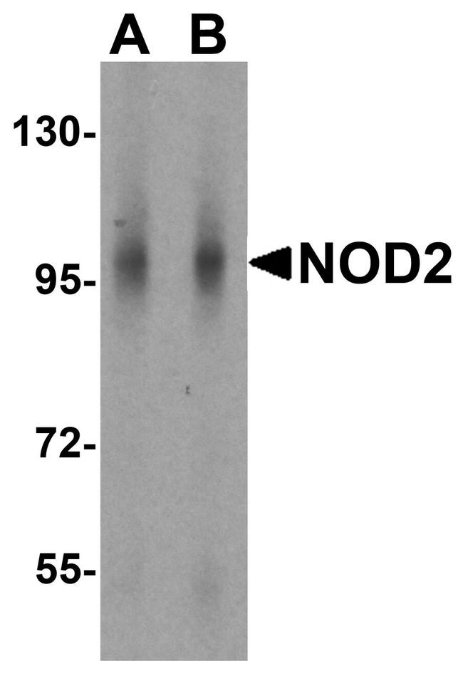 NOD2 Antibody in Western Blot (WB)