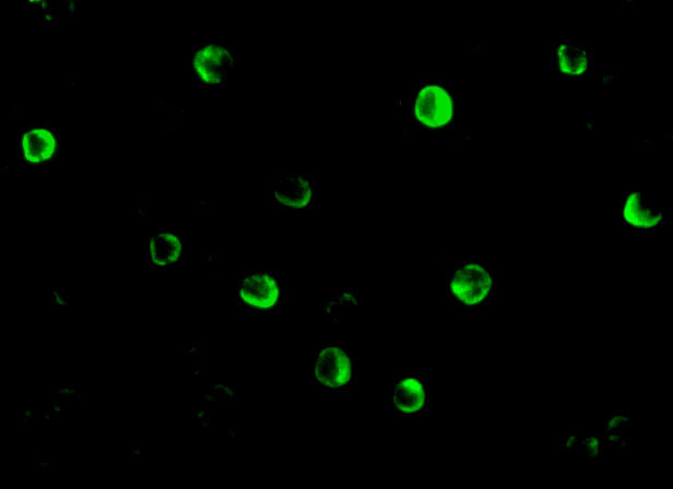 NOD2 Antibody in Immunocytochemistry (ICC/IF)