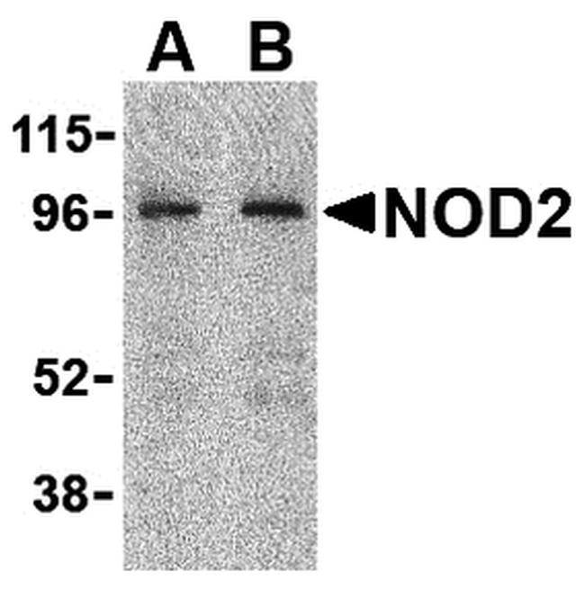 NOD2 Antibody in Western Blot (WB)