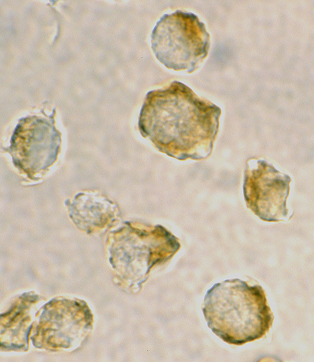 Nudel Antibody in Immunocytochemistry (ICC/IF)