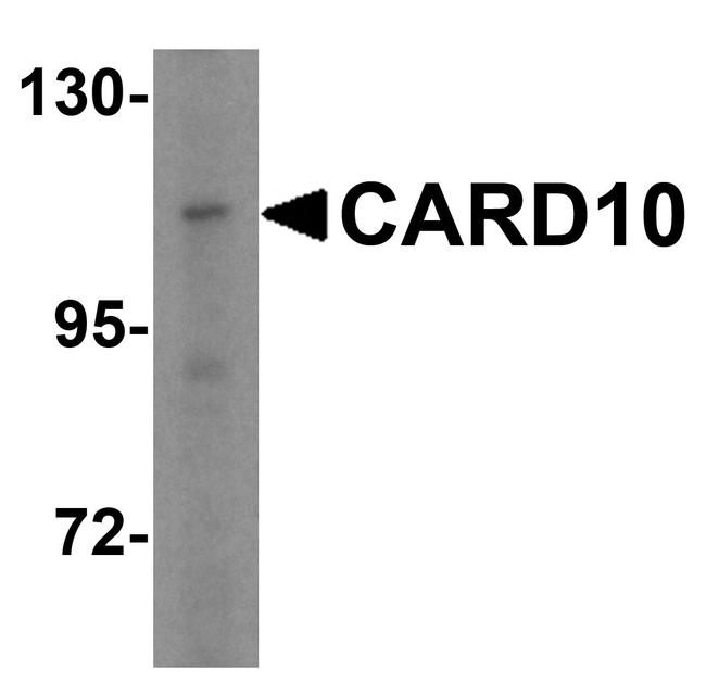 CARD10 Antibody in Western Blot (WB)