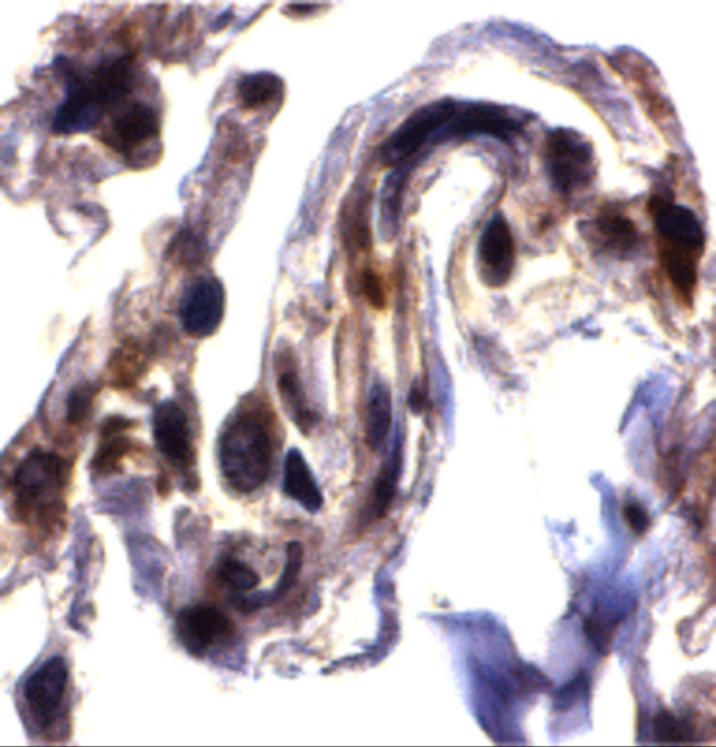 ARTS Antibody in Immunohistochemistry (IHC)