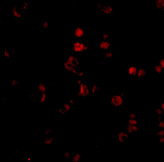 AATF Antibody in Immunocytochemistry (ICC/IF)