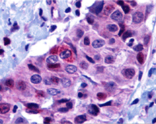 PUMA alpha Antibody in Immunohistochemistry (Paraffin) (IHC (P))