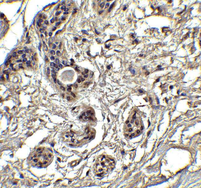 PUMA alpha Antibody in Immunohistochemistry (Paraffin) (IHC (P))