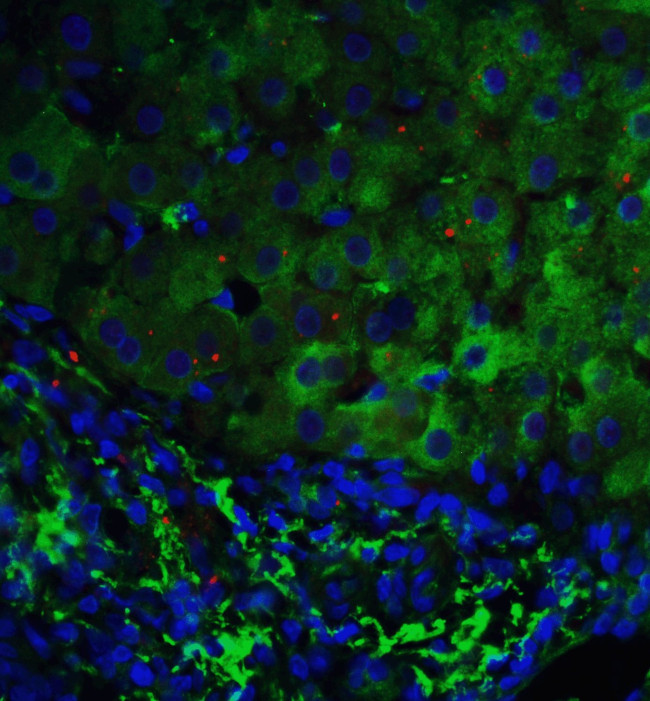 p53DINP1 Antibody in Immunohistochemistry (IHC)