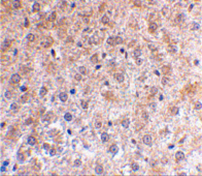 p53DINP1 Antibody in Immunohistochemistry (IHC)