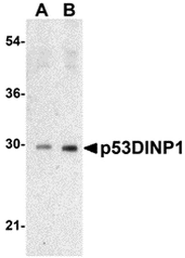 p53DINP1 Antibody in Western Blot (WB)
