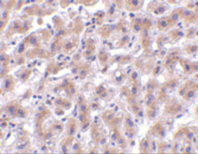 HTRA2 Antibody in Immunohistochemistry (IHC)