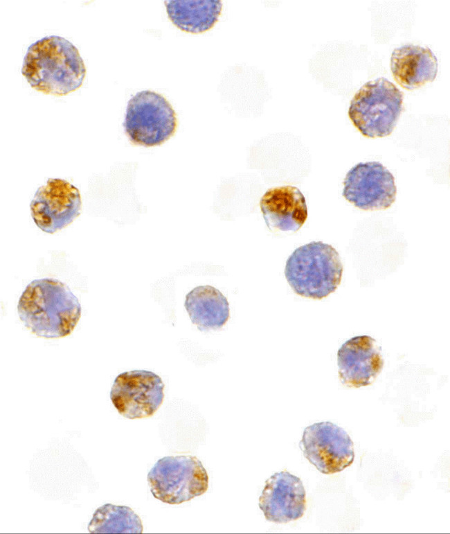 AID Antibody in Immunocytochemistry (ICC/IF)