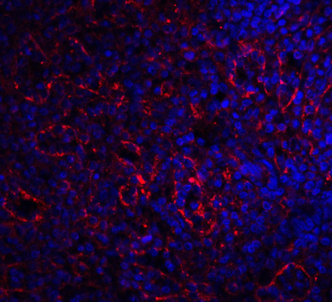 CD268 (BAFF Receptor) Antibody in Immunohistochemistry (IHC)