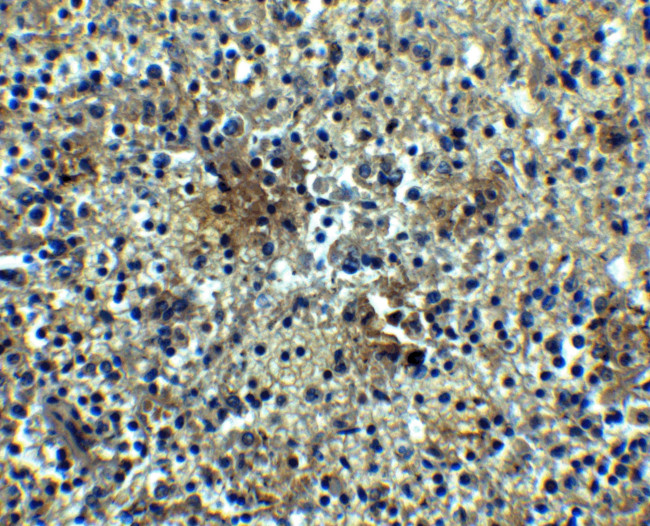 CD268 (BAFF Receptor) Antibody in Immunohistochemistry (IHC)