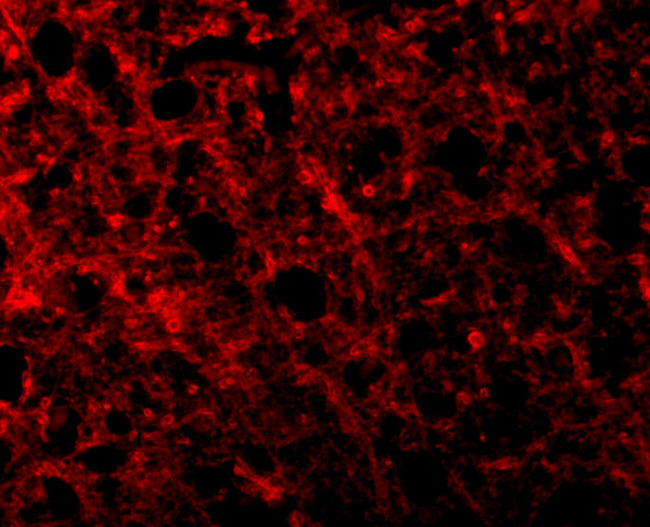 TEM8 Antibody in Immunohistochemistry (IHC)