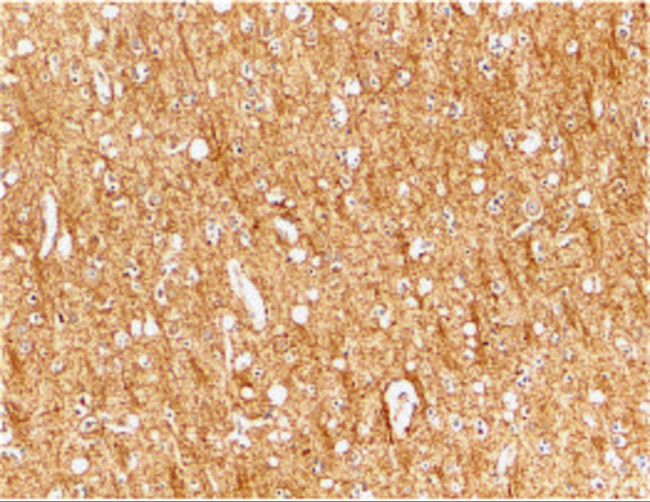 TEM8 Antibody in Immunohistochemistry (IHC)