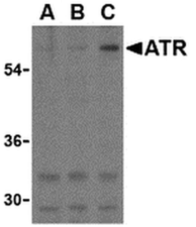 TEM8 Antibody in Western Blot (WB)