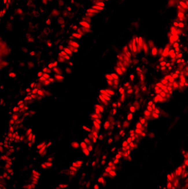 PHAP Antibody in Immunohistochemistry (IHC)