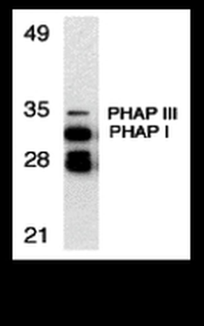 PHAP Antibody in Western Blot (WB)