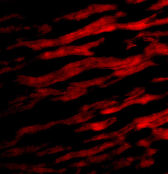 TIRAP Antibody in Immunocytochemistry (ICC/IF)