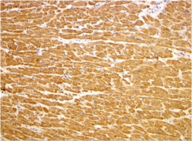 TIRAP Antibody in Immunohistochemistry (IHC)