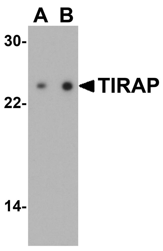 TIRAP Antibody in Western Blot (WB)