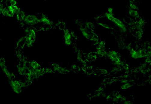 TRIF Antibody in Immunocytochemistry (ICC/IF)